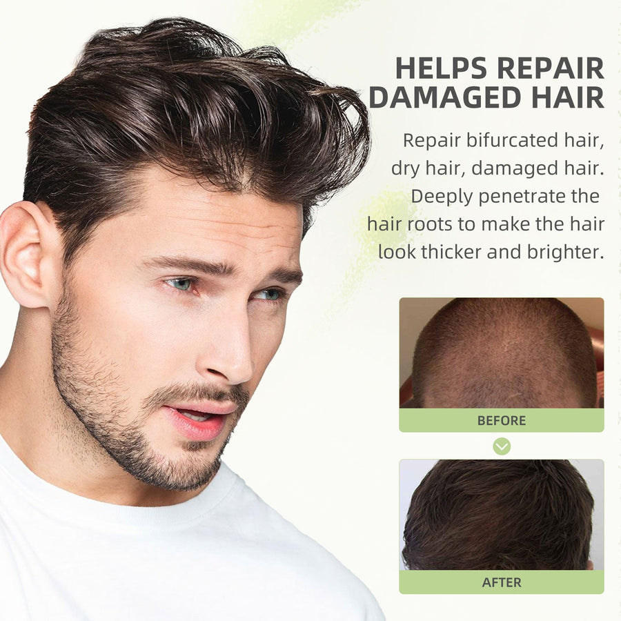 Black Castor Oil Capsules for Softer, Glossier Hair