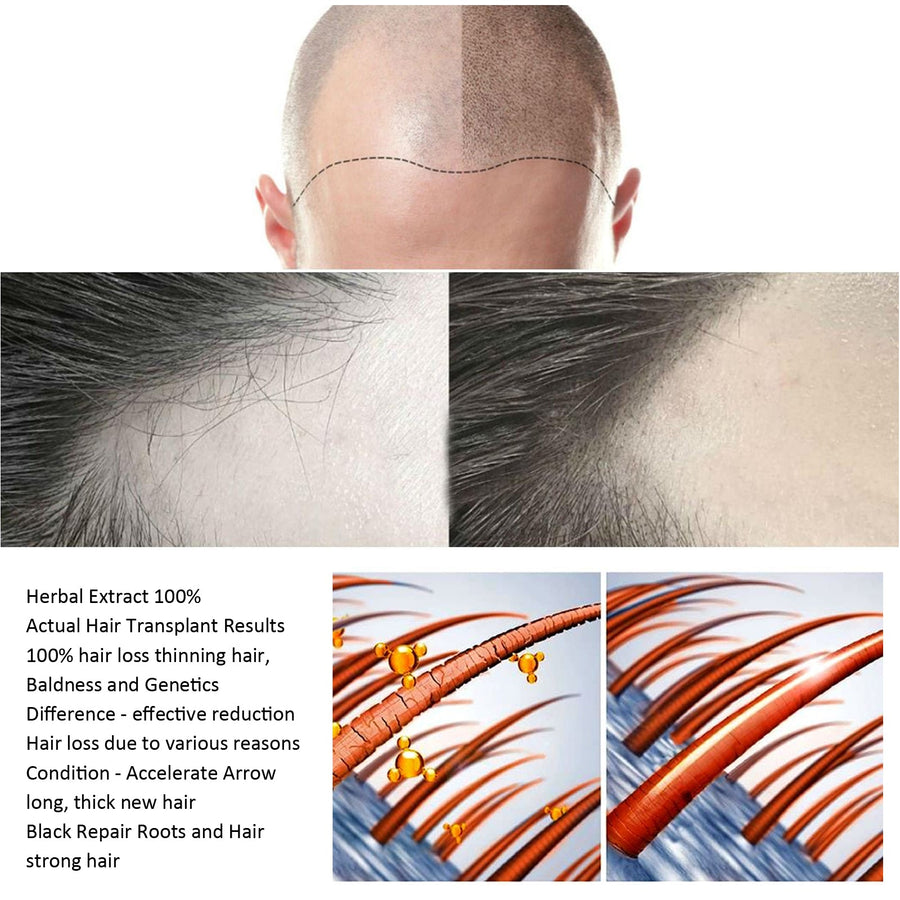 Hair Treatment Spray – Stop Hair Loss & Activate New Growth