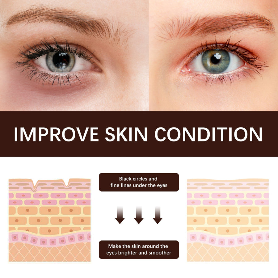 Retinol Eye Cream for Fine Lines & Dark Circles