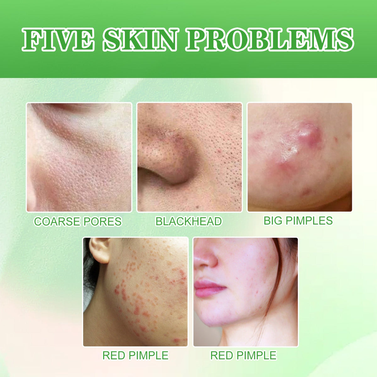 Glycolic Acid Facial Pads — Smoother, Brighter Skin in Days