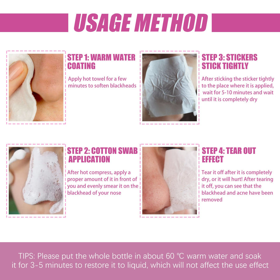 Aloe Vera Blackhead Gel for Clearer-Looking Pores