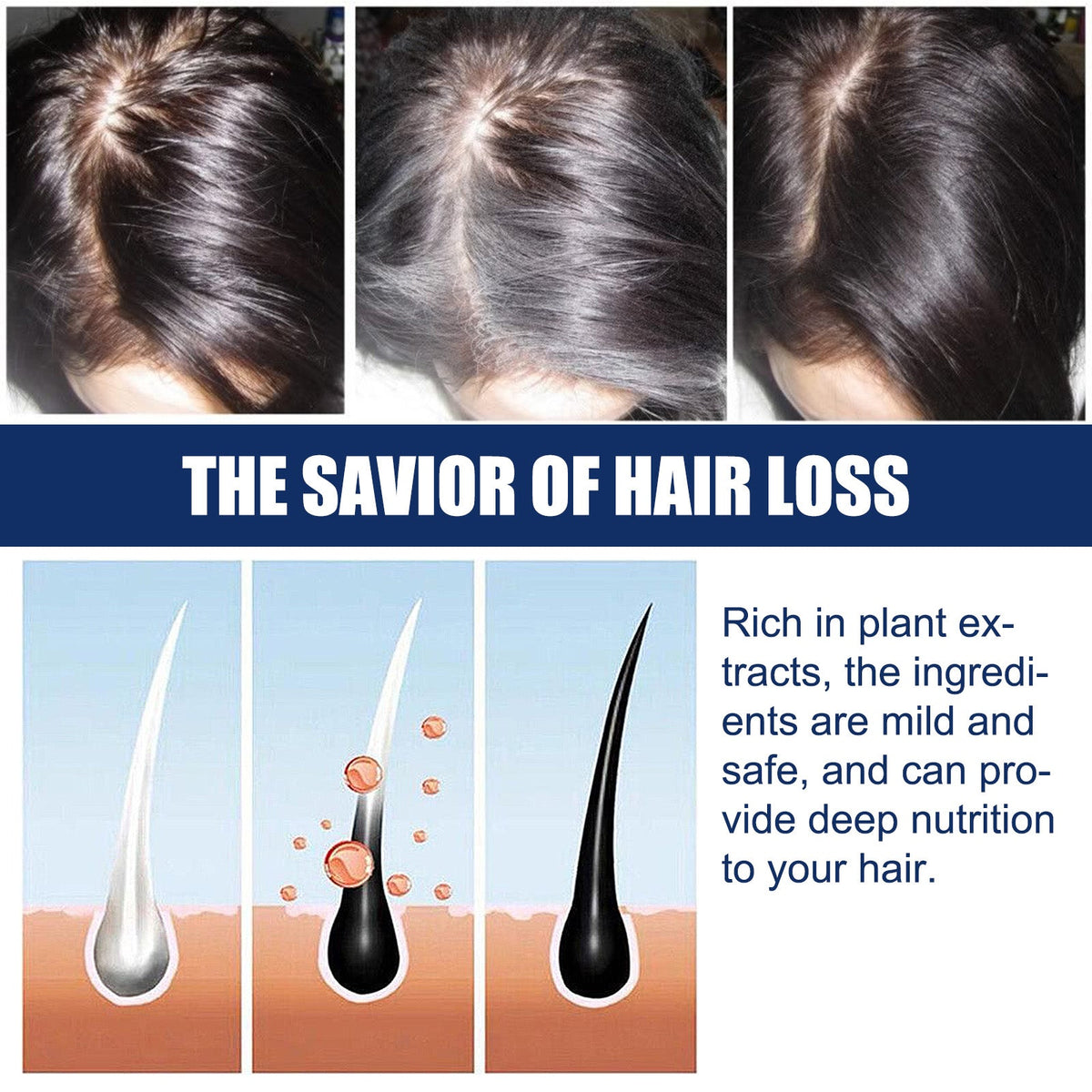 Hair Growth Cream for Thinning Hair & Scalp Support