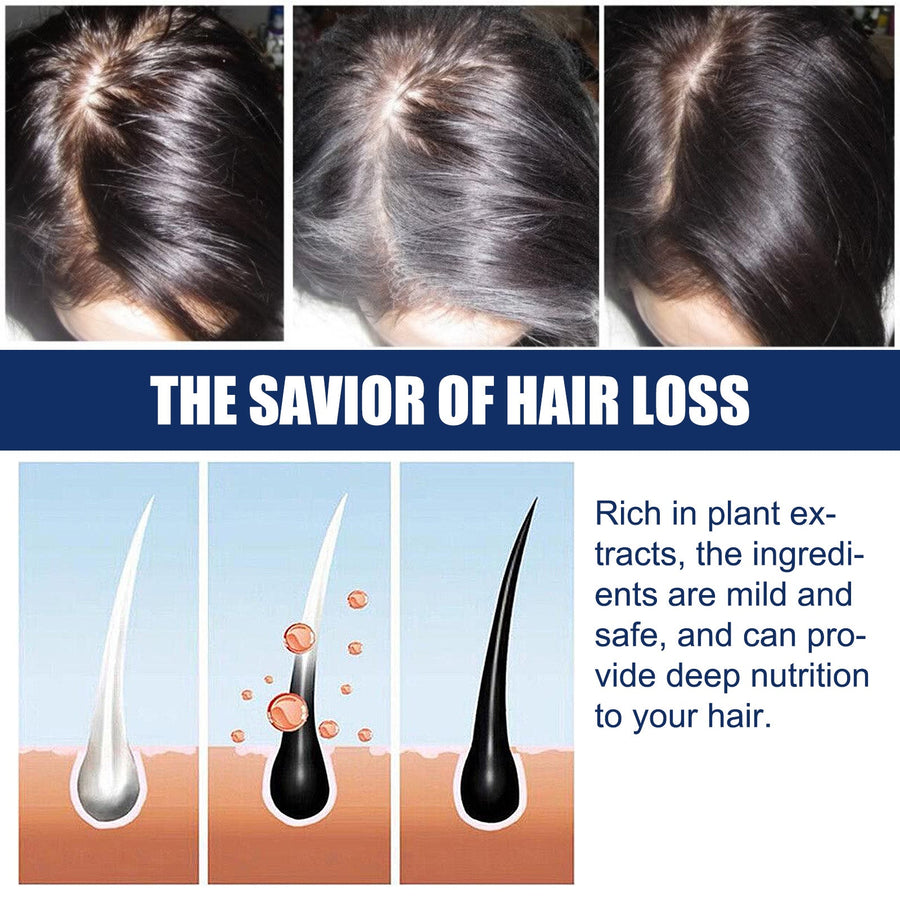 Hair Growth Cream for Thinning Hair & Scalp Support