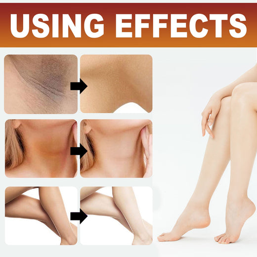 Dark Spot Corrector Body Cream for Underarms & Joints