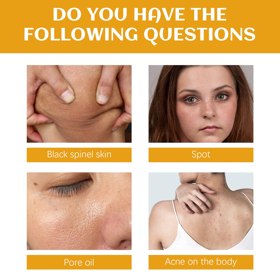 Spot Cleanser for Face & Body That Brightens Skin