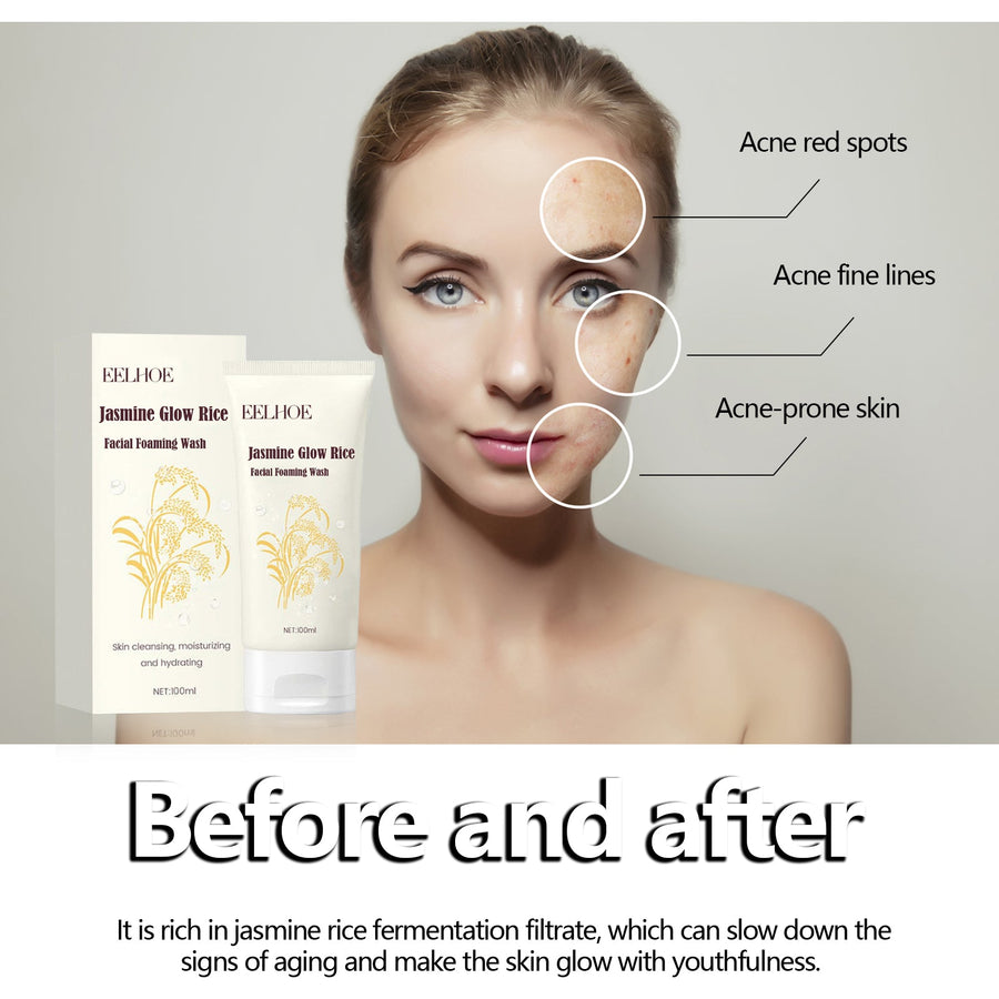 Jasmine Rice Facial Cleanser for Sensitive, Blemish-Prone Skin