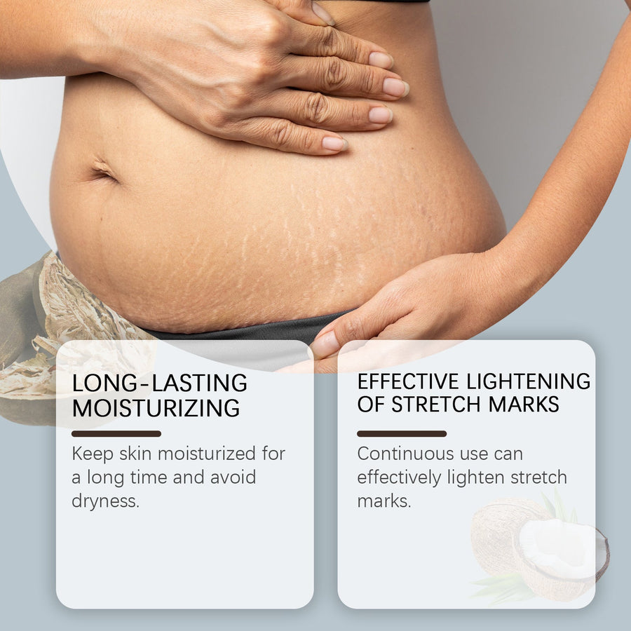 Post-Natal Body Cream for Stretch Mark Repair & Elasticity