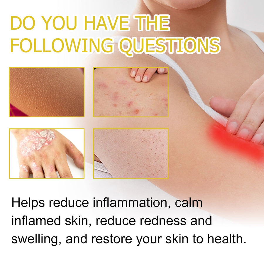 Psoriasis Cream for Itchy, Red, Irritated Skin Relief