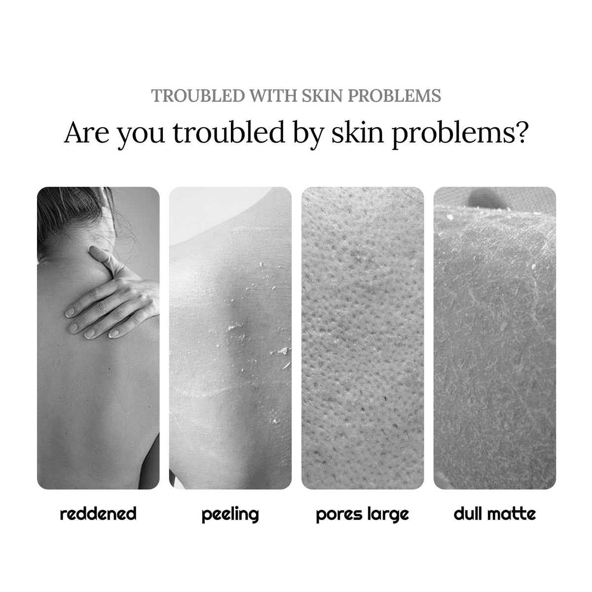 Propolis Honey Shower Lotion for Soft, Exfoliated Skin