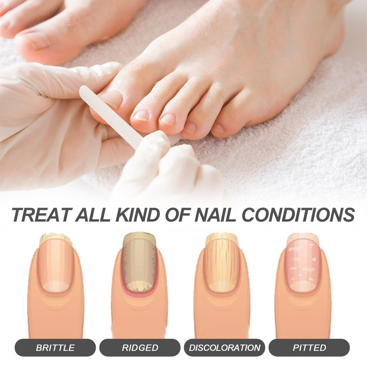 Cuticle Oil Pen, Repair Hands And Feet Gray Nails Protect Na