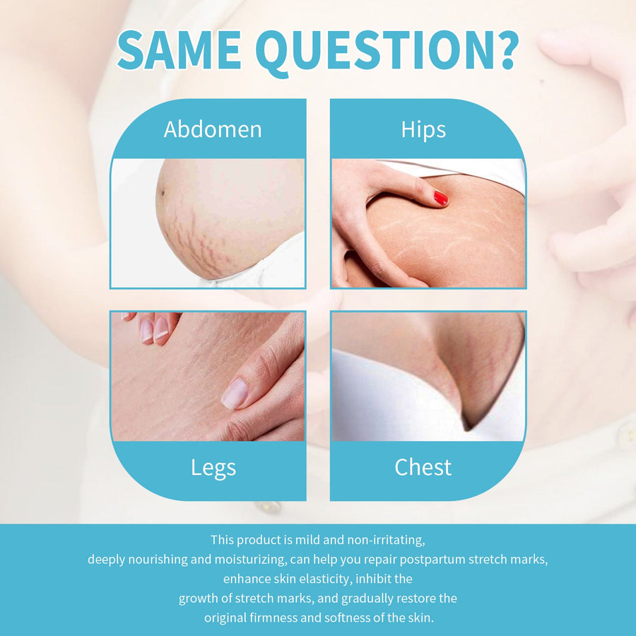Stretch Mark Repair Cream for Pregnancy Skin Recovery