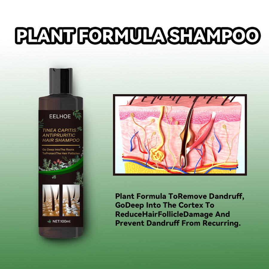 Anti-Dandruff Shampoo for Itchy, Oily Scalp Care