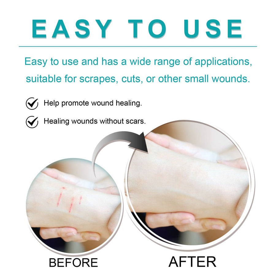 Liquid Bandage Drops – Transparent Protective Film