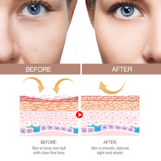 EELHOE Facial Balm for Fine Lines & Elasticity