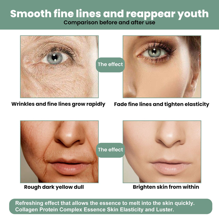 Collagen Anti-Aging Serum for Fine Lines & Dark Spots