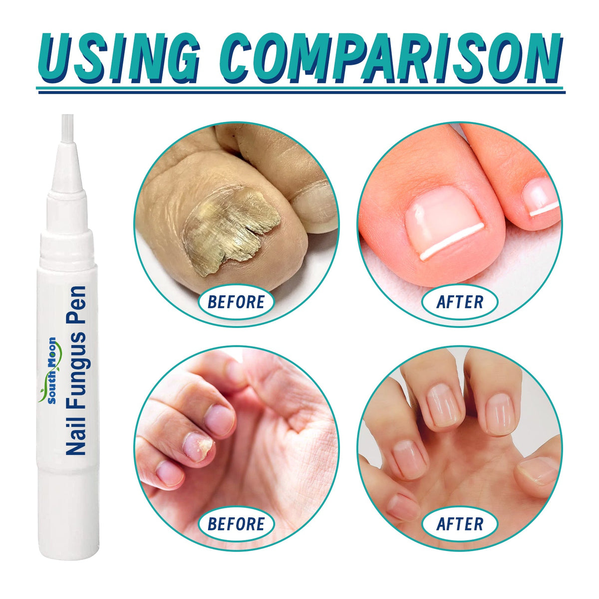 Gentle Precision Nail Care Pen