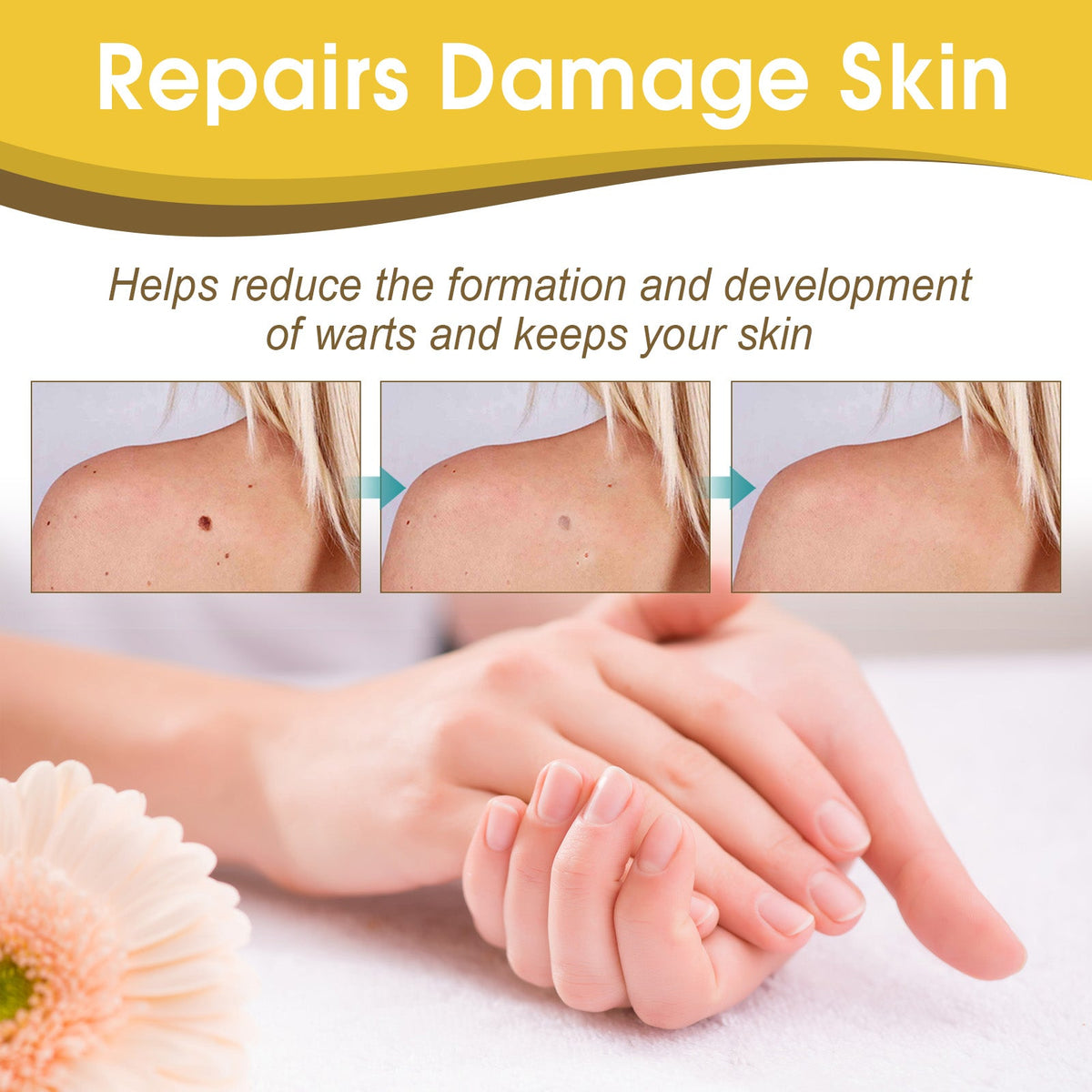 Bee Venom Care Gel for Visible Blemish Reduction