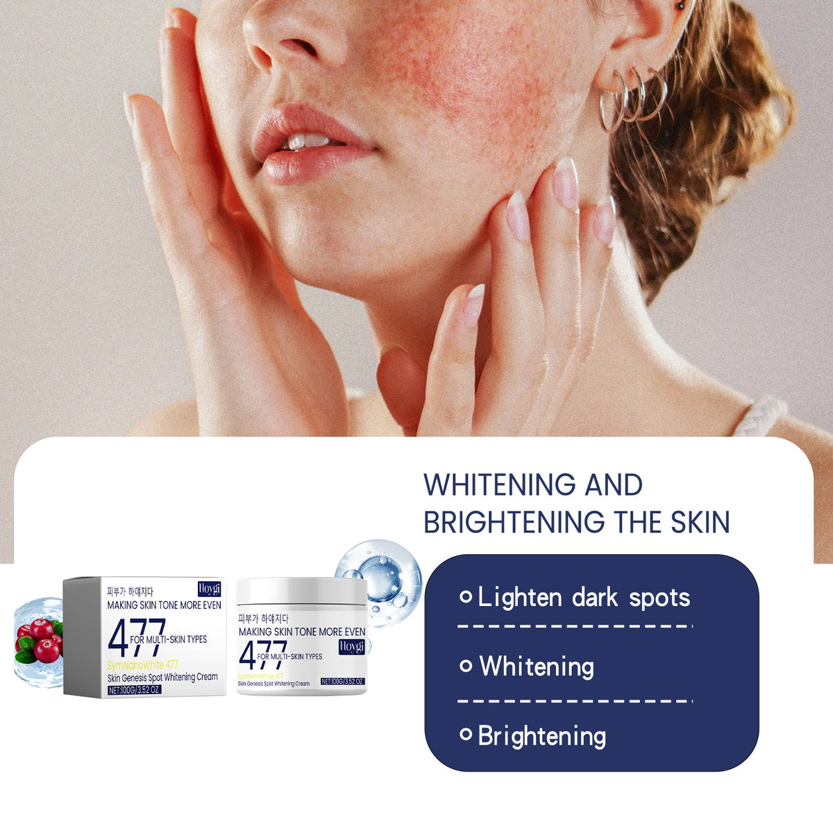 Skin Genesis Spot Cream: Even Tone, Fade Dark Spots