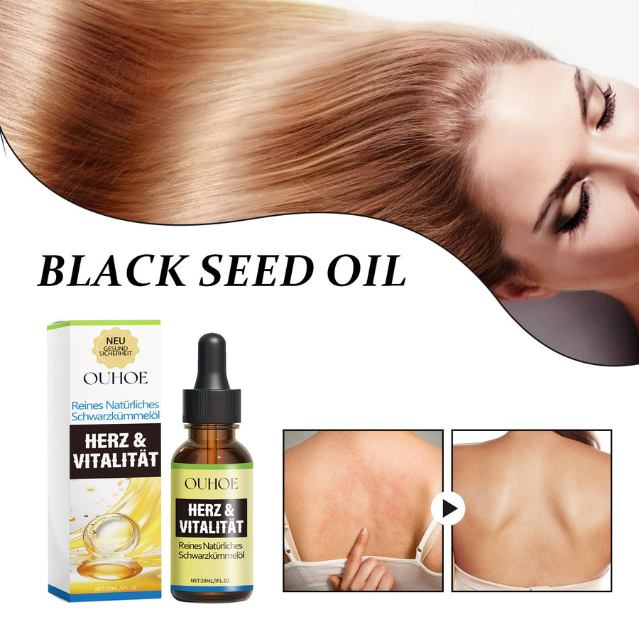 Black Seed Oil for Hair Loss, Scalp & Dry Itchy Skin