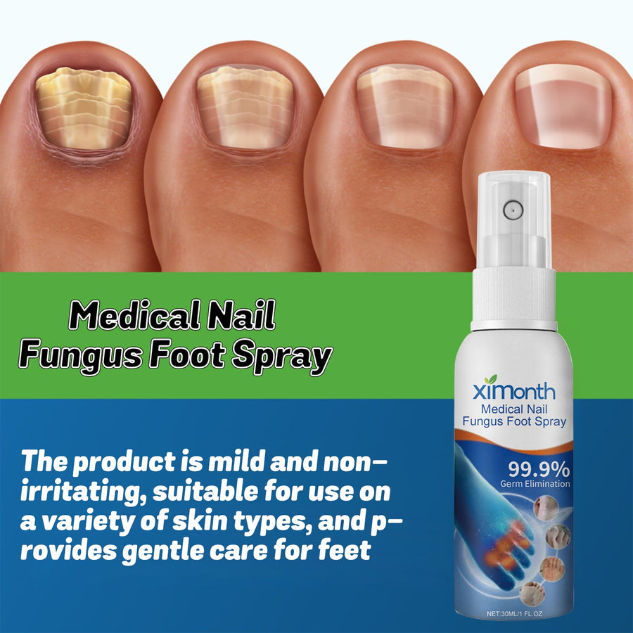 Nail Fungus Spray - Repair Thick Gray Damaged Toenails Fast
