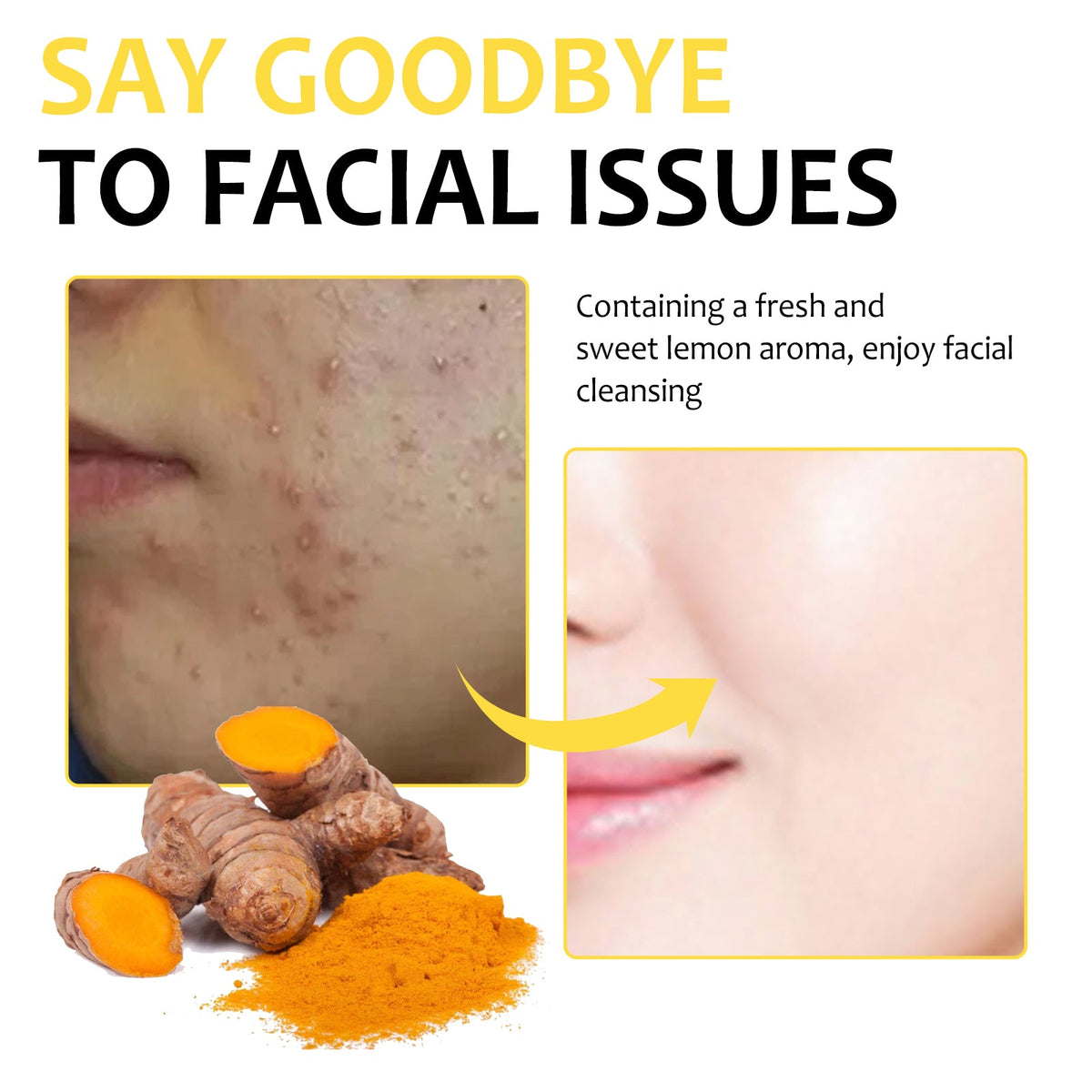 Turmeric Cleansing Pads for Oily, Uneven Skin
