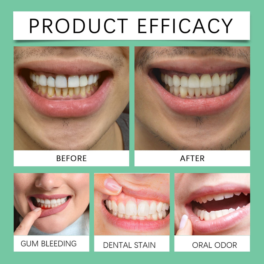 Gum Care Gel – Soothe & Repair Sensitive Gums