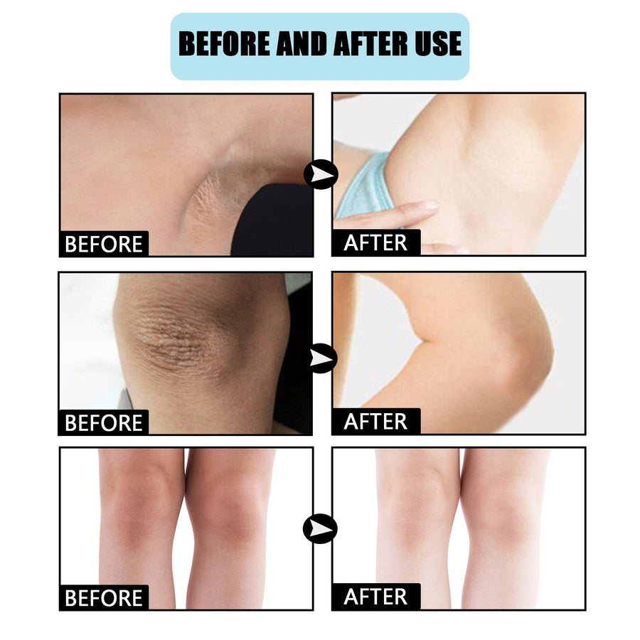 Brightening Body Cream for Dark Elbows, Knees & Underarms