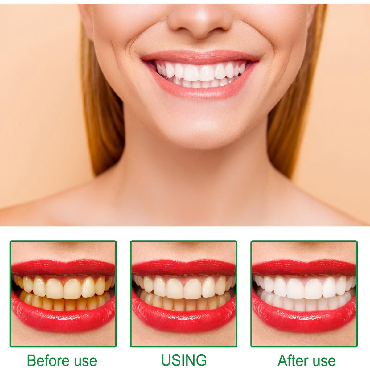 Teeth Whitening Gel Pen — Visible Whiter Teeth in 7 Days