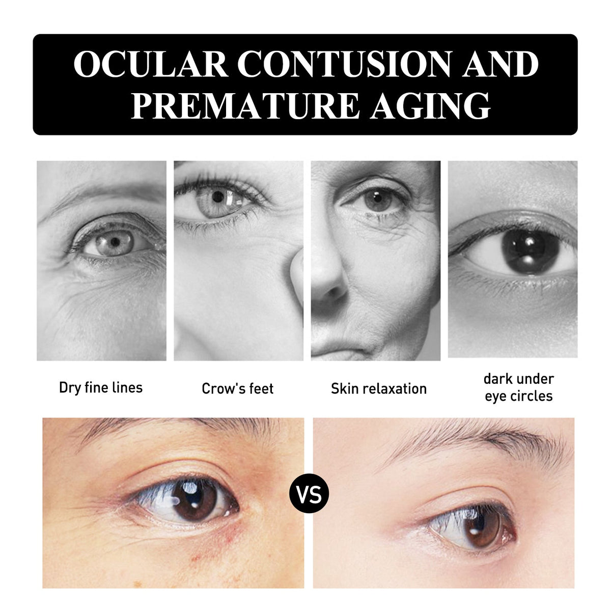 Snake Venom Peptide Eye Cream for Dark Circles & Lines