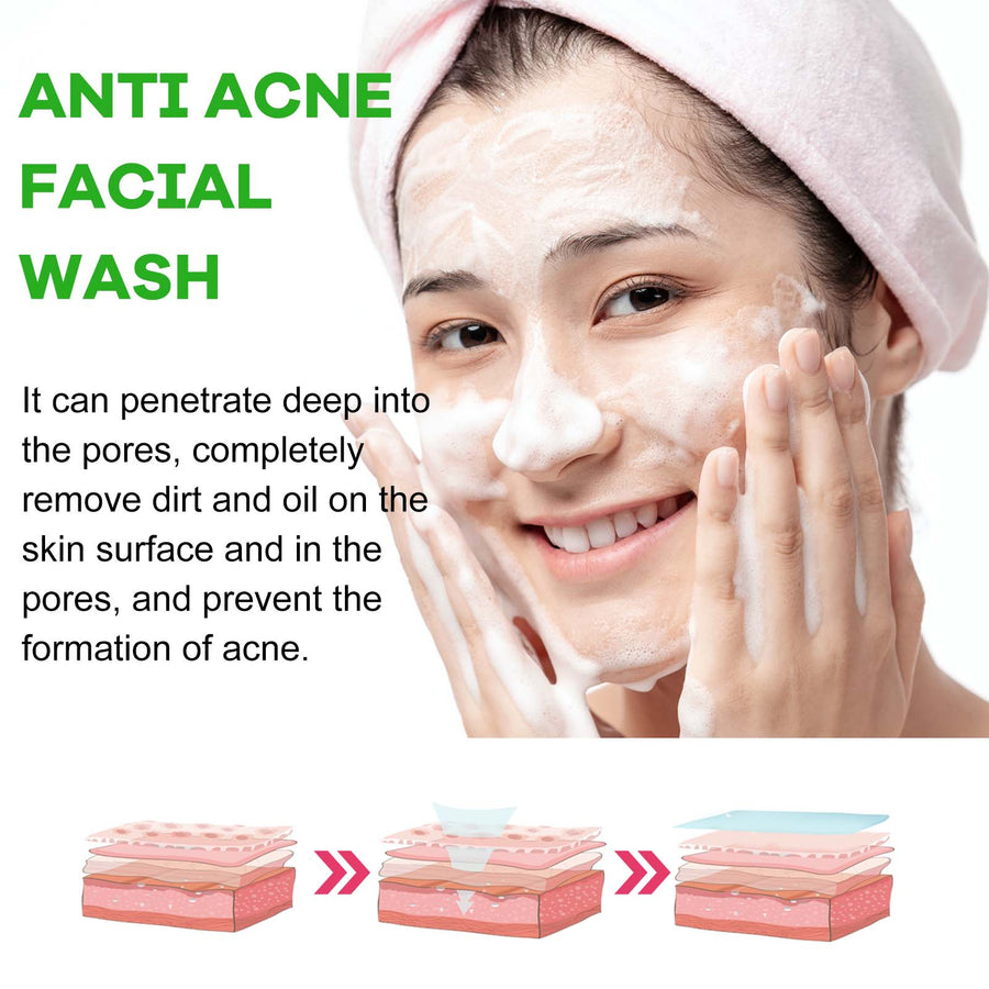 Anti Acne Facial Wash for Oily Skin & Blackheads