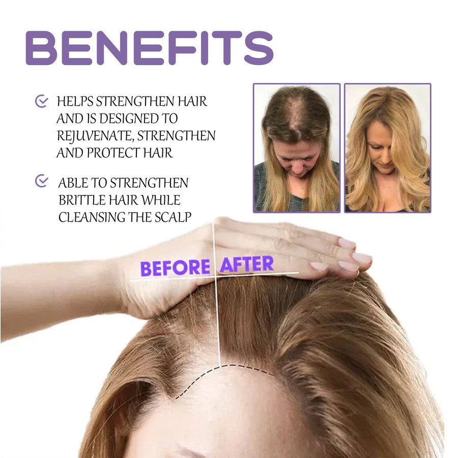 Hair Follicle Dense Drops — Thicker, Fuller Hair in 30 Days