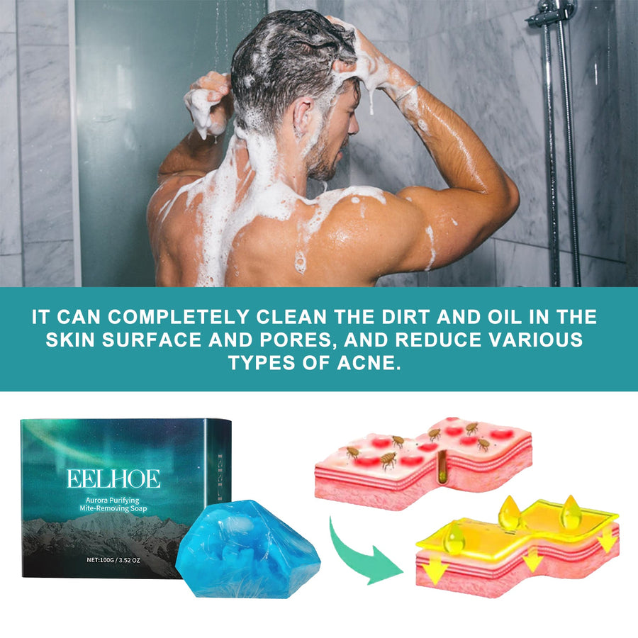 Aurora Mite-Removing Soap for Acne-Prone Skin