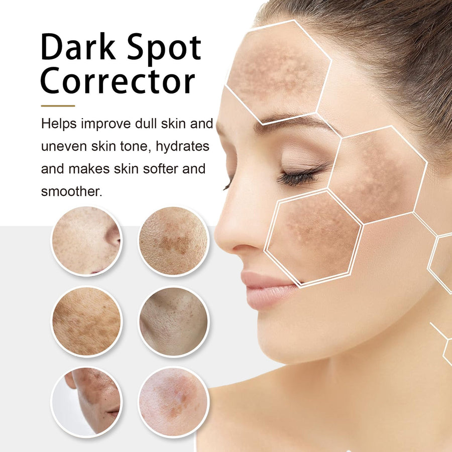 Dark Spot Corrector Serum - Fade Spots, Even Skin Tone