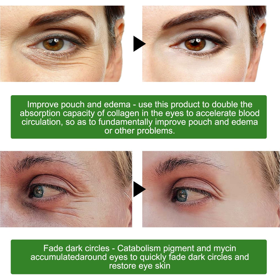 Seaweed Firming Eye Mask — Reduce Fine Lines & Dark Circles
