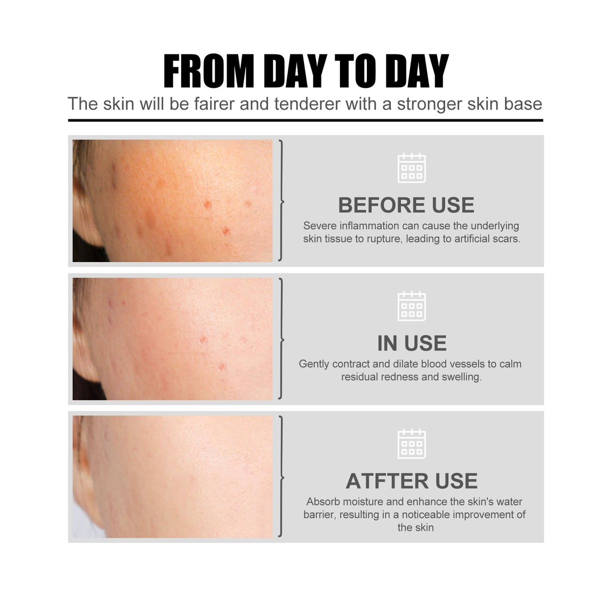 Niacinamide Face Essence for Acne Marks & Pores