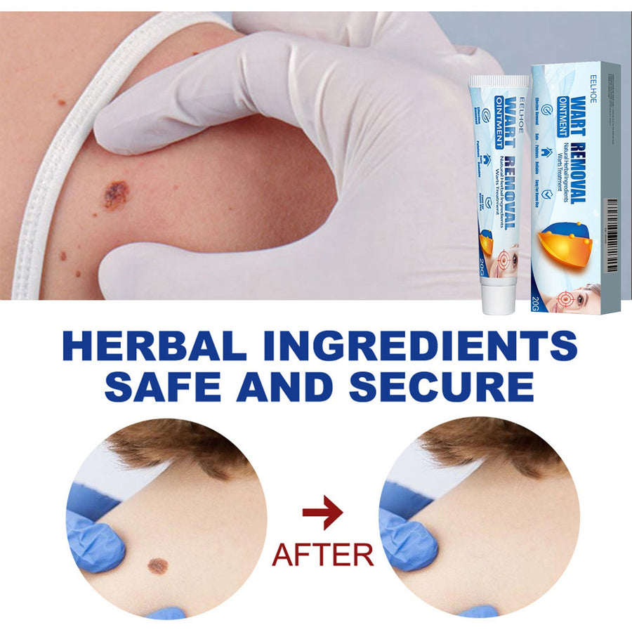 Keyu Cream Clean Skin Repair Care Body Face Remove Face Labe