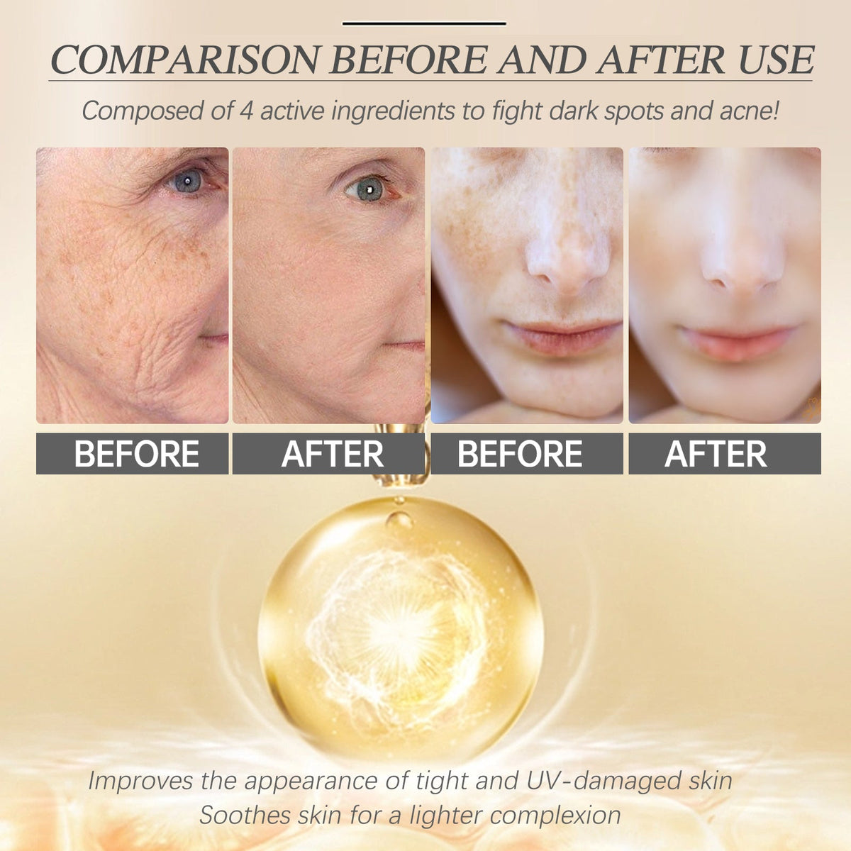Retinol Essence 6.5% for Melasma and Fine Lines