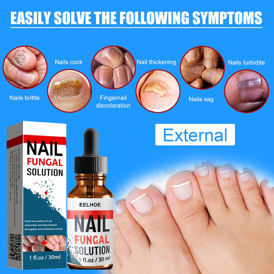 Nail Fungus Treatment — Clearer, Healthier Nails in 4-8 Weeks