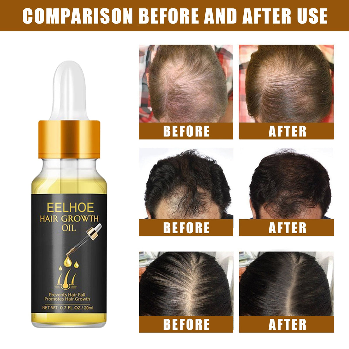 Hair Growth Oil for Fuller-Looking, Stronger Hair