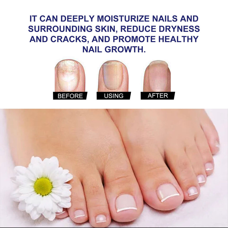 Nail Care Drops for Discolored, Thickened Nails