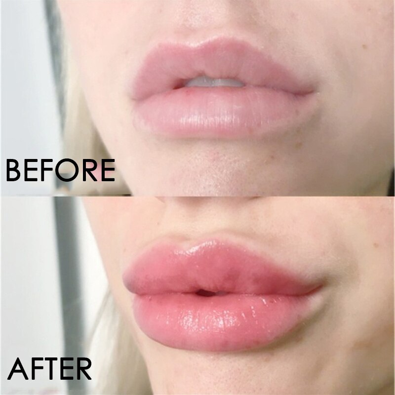 Lip Plumper Serum for Glossy, Moisturized Fuller Lips