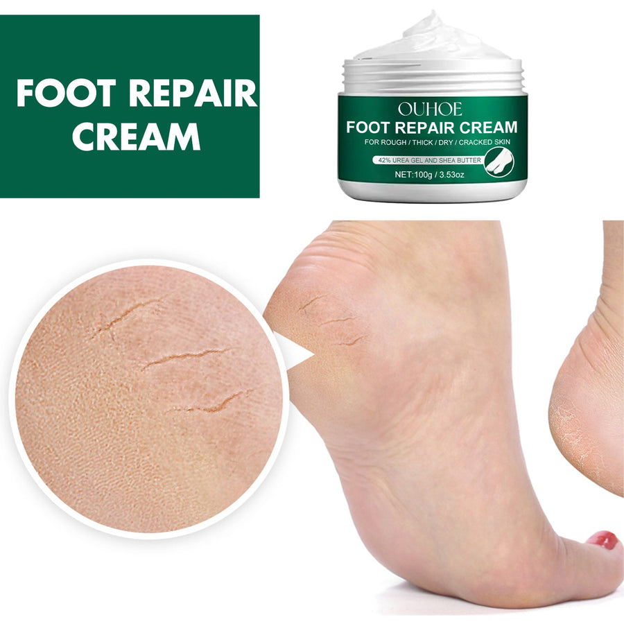 Foot Repair Cream 42% Urea for Cracked Heels