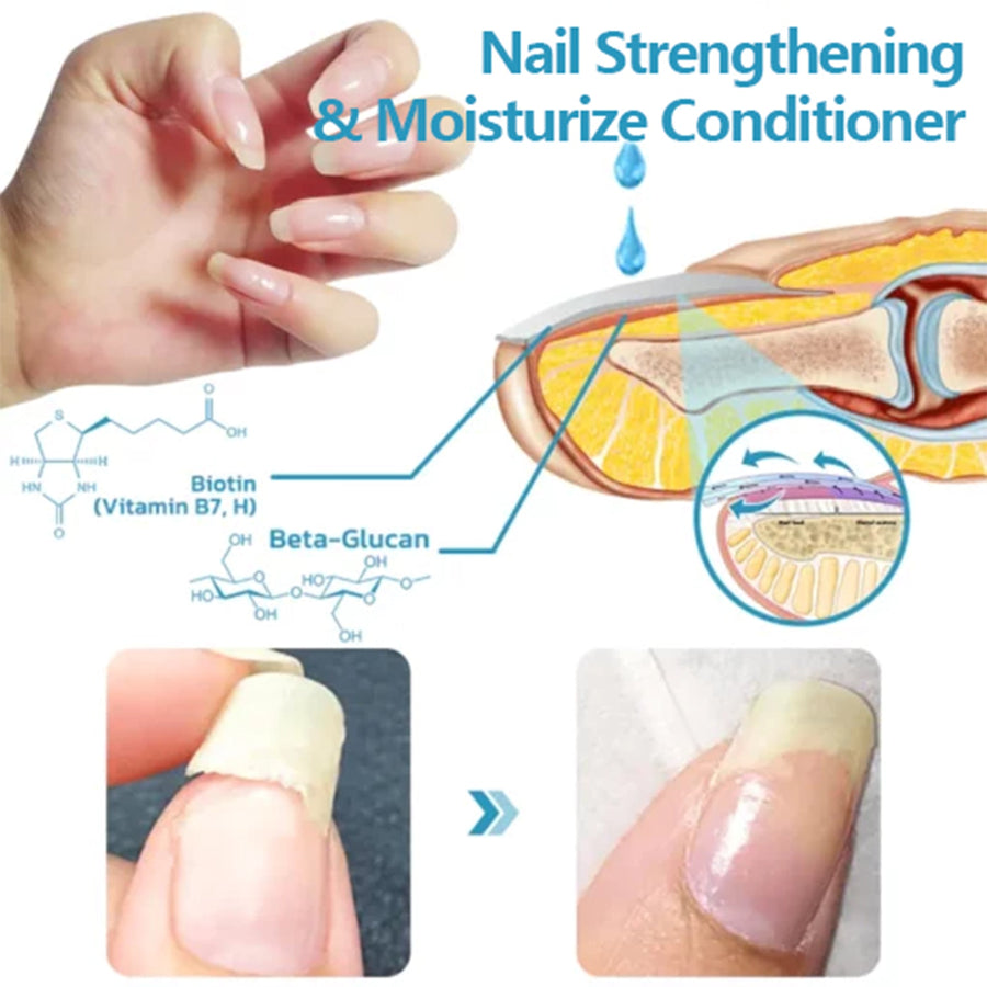 Nail Repair Solution for Thick Discolored Nails