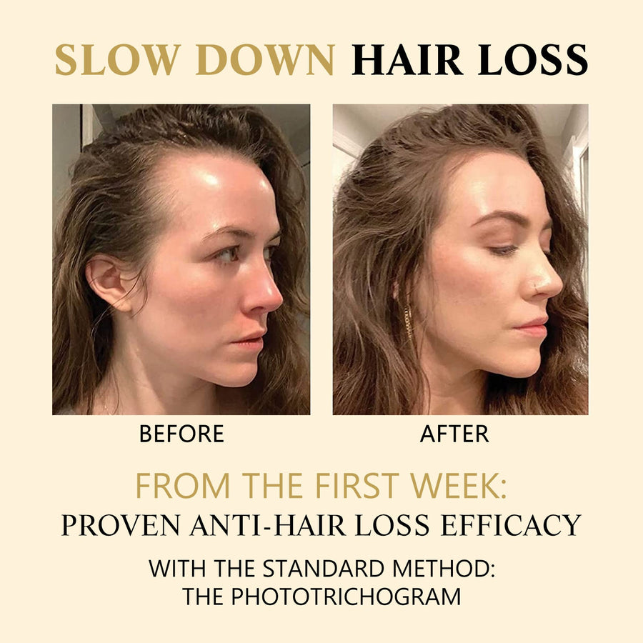 Hair Darkening & Thickening Essence — Roll-On Scalp Restoration