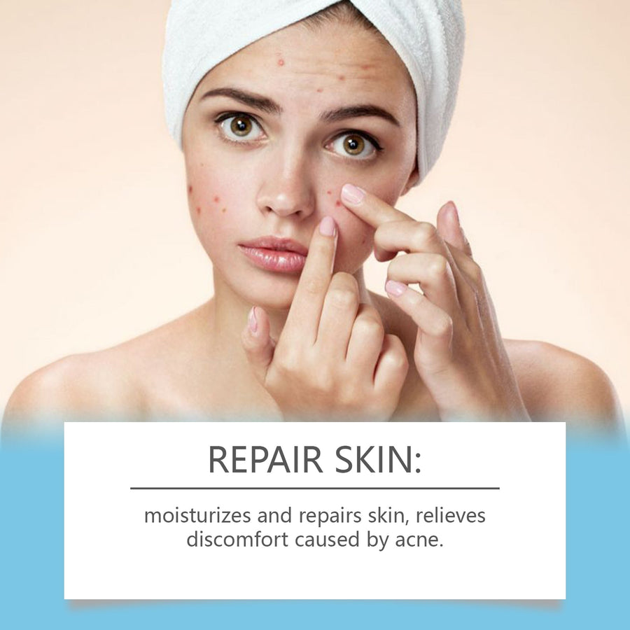 Acne Repair Cream for Closed Comedones & Acne Scars
