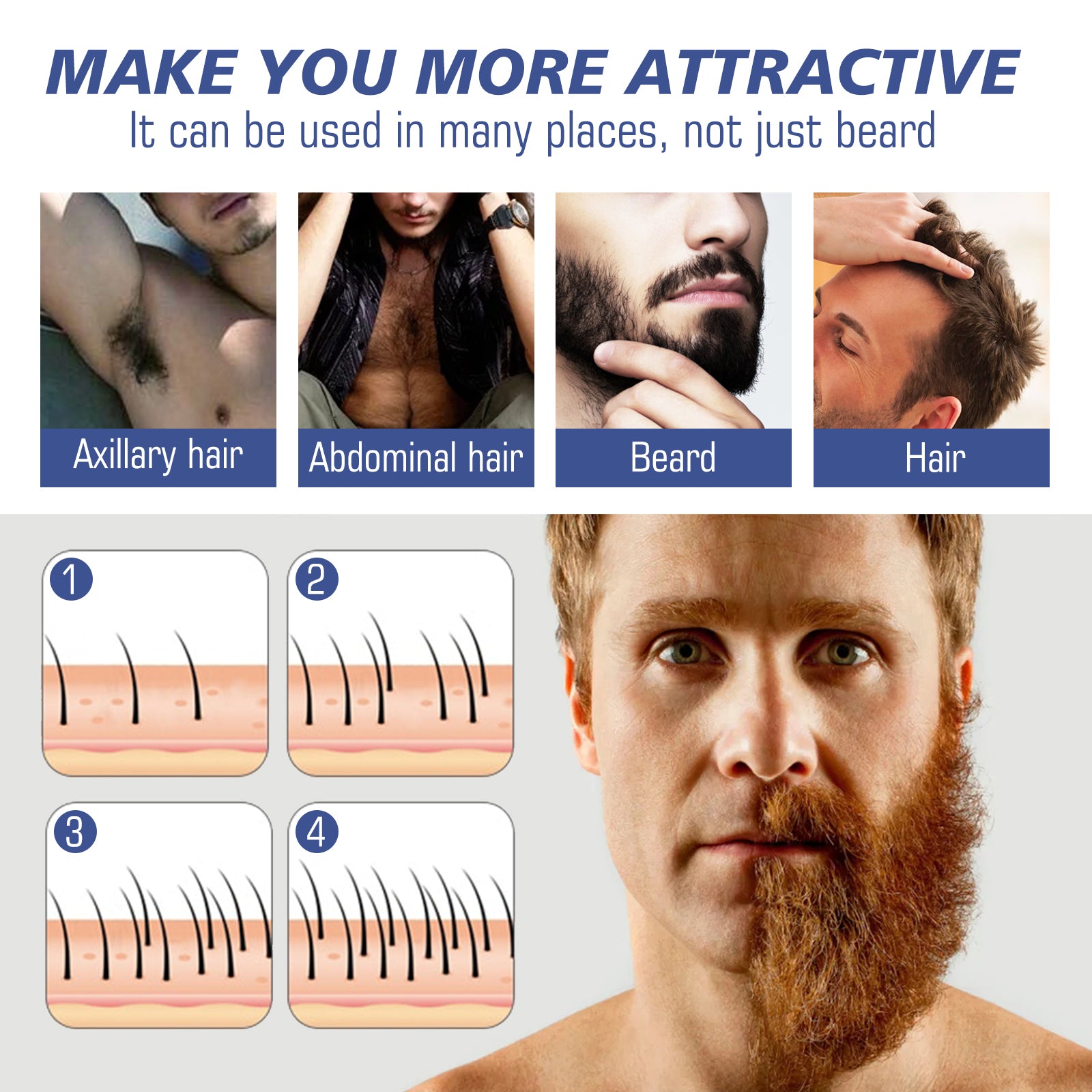 Infographic titled 'Thin Hair Reduces the Charm' showing four problem scenarios: slow beard growth, thin eyebrows, hairline recession, and lack of chest hair