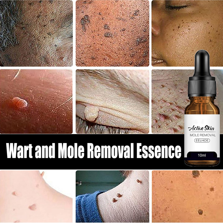 Skin Essence Mole Removal Serum – Smooth Clear Skin