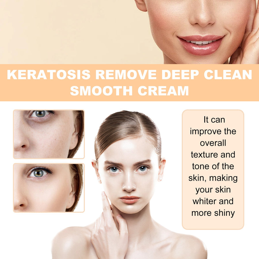 Keratosis Cream for Bumpy Skin, Clogged Pores & Texture