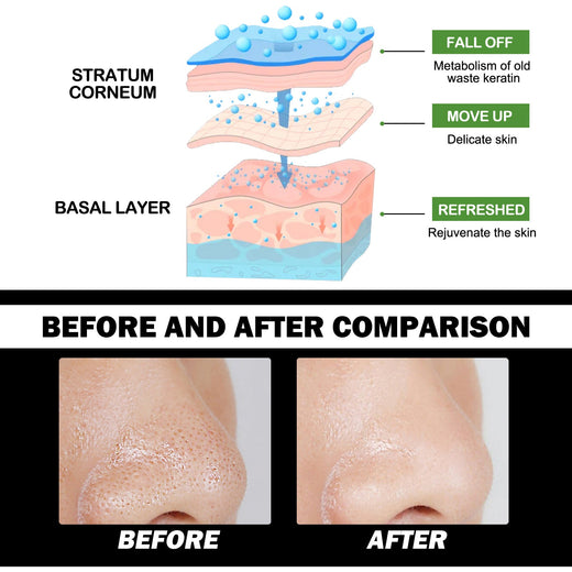 Bamboo Charcoal Peel-Off Mask for Blackhead Removal