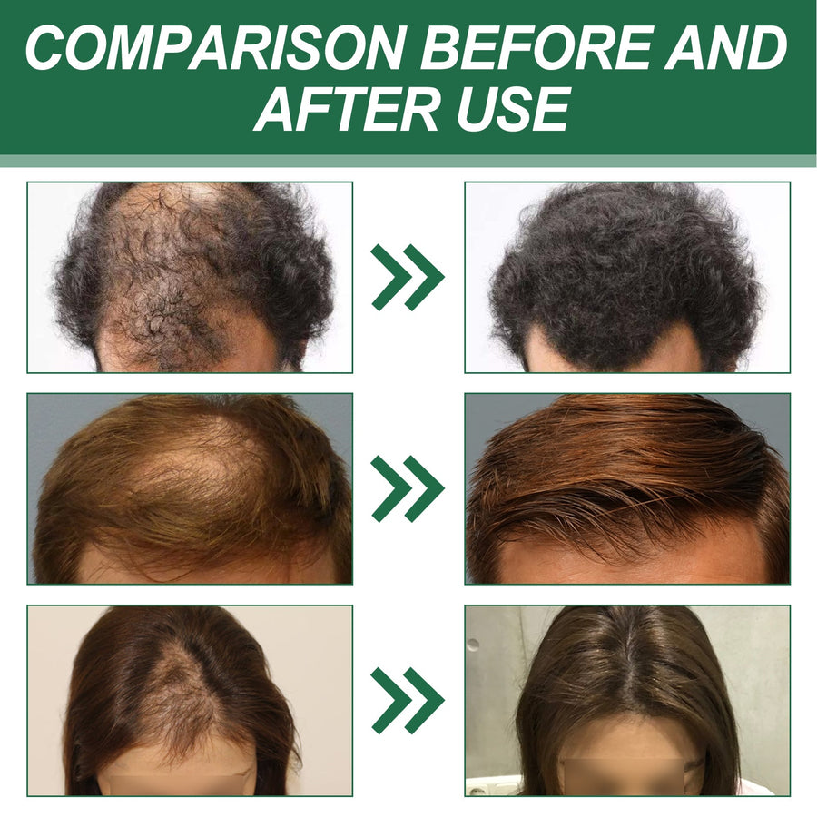 Red Ginseng Hair Spray for Stronger, Fuller-Looking Hair